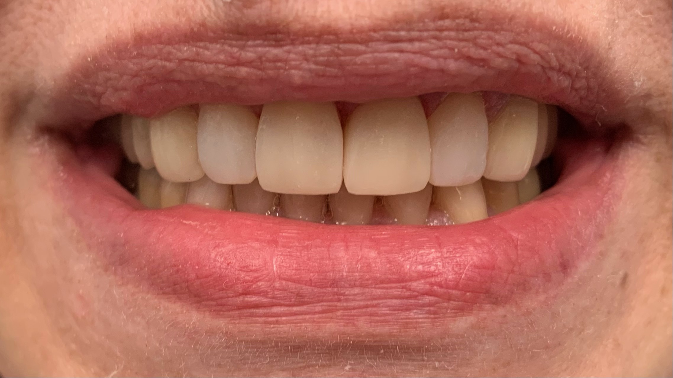 zęby przed specjalistycznymi zabiegami