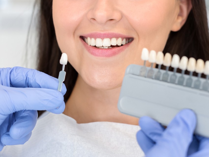 Kobieta z pięknym śnieżno białym uśmiechem u po wizycie u dentysty
