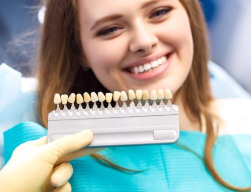 Wybielanie zębów – wszystko, co musisz wiedzieć!