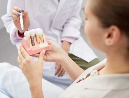 Implant zęba – czy warto zainwestować w sztuczny ząb?