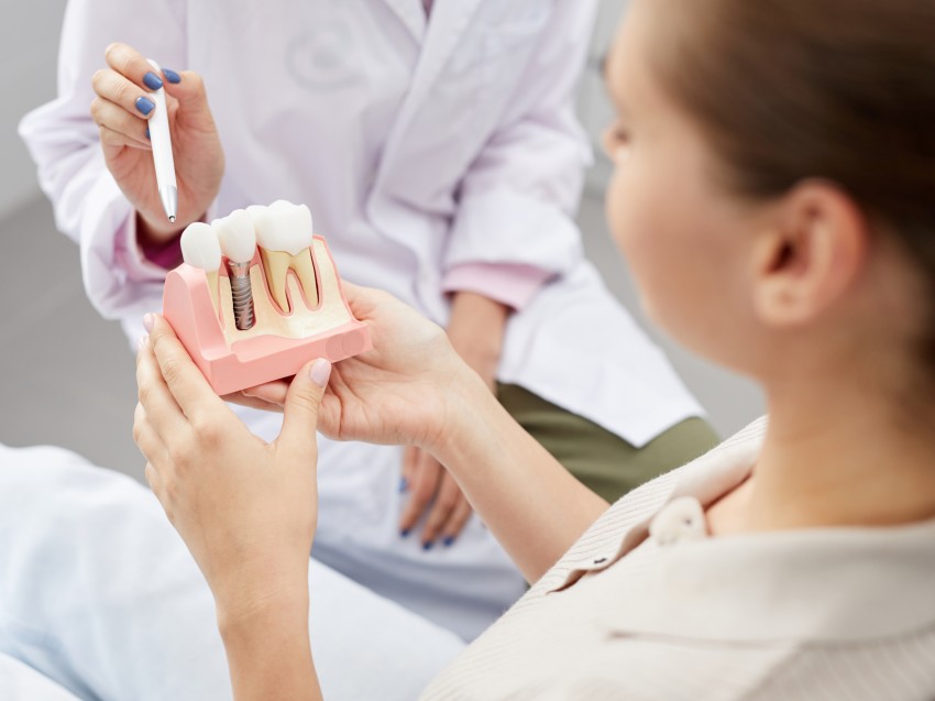 Implant zęba – czy warto zainwestować w sztuczny ząb?
